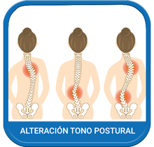 Abordaje Tono Postural